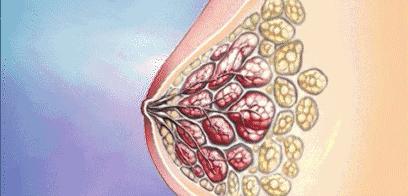 如何快速丰胸且不会反弹,不吃药怎么丰胸