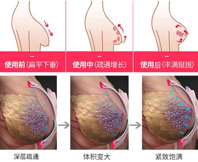 有什么方法可以丰胸不用丰胸产品,其实丰胸很简单呀