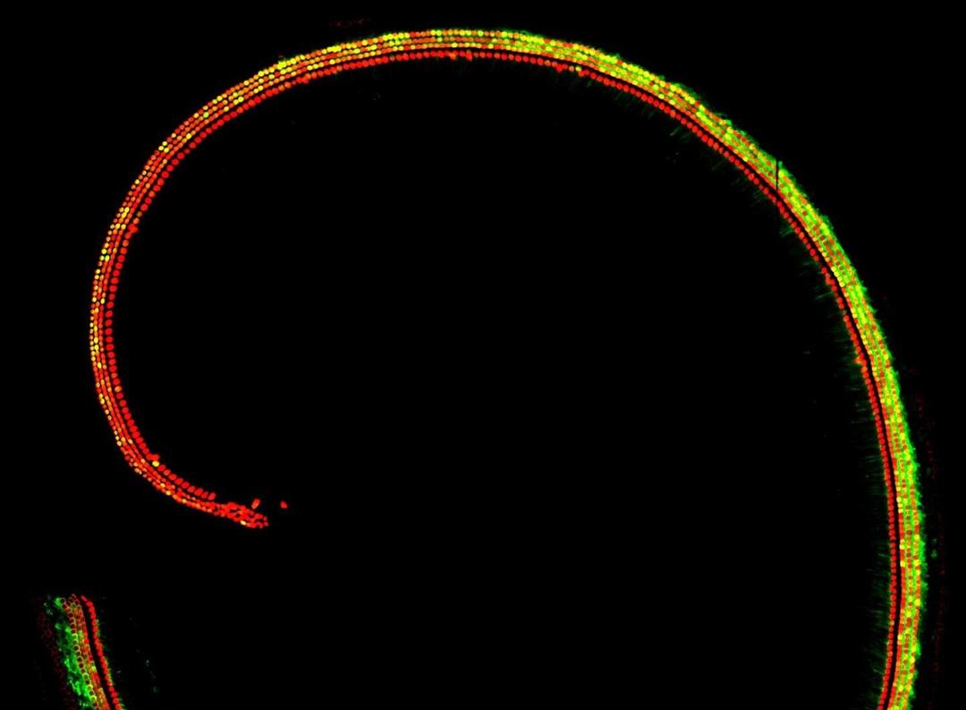 最新耳聋基因治疗人体实验,基因疗法治遗传性听力最新消息