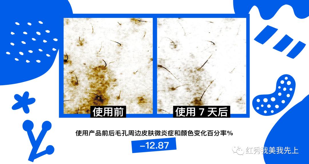 靠精华可以提升紧致吗,精华水可以收缩毛孔吗