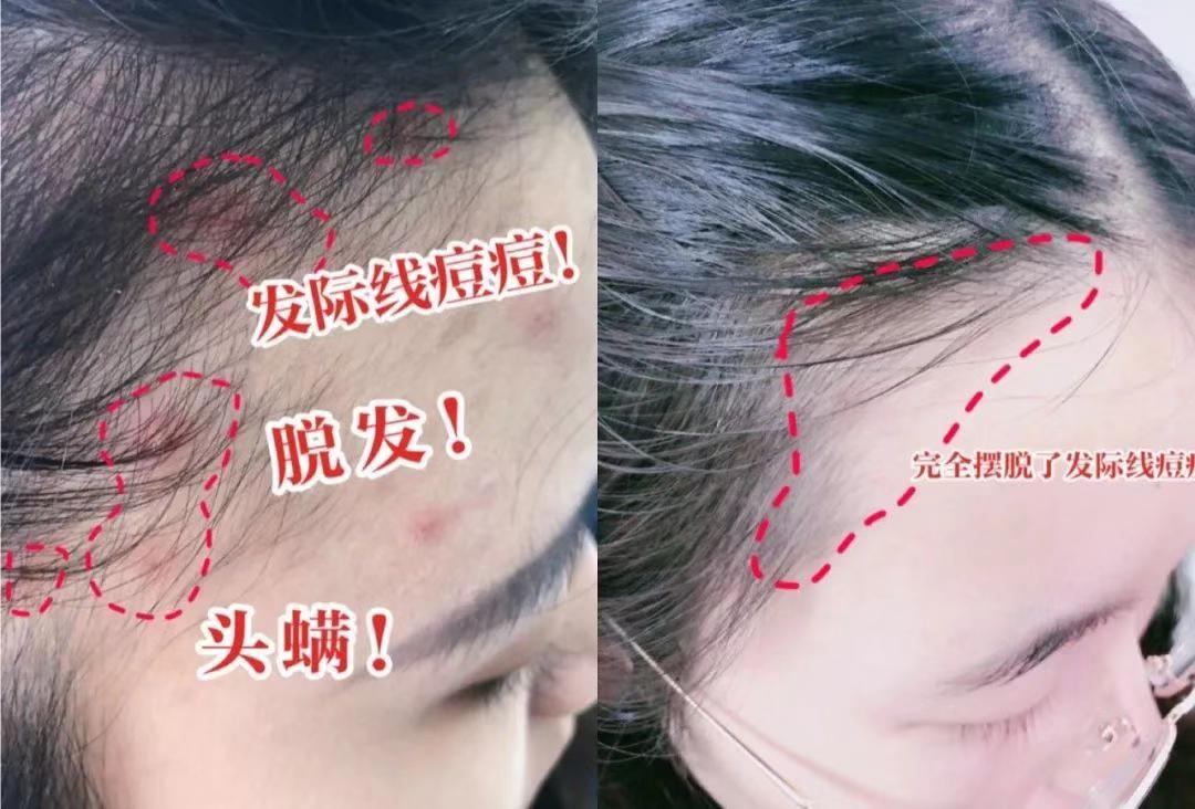 品牌干发帽吸水速干不伤头发,速干帽加厚超强吸水