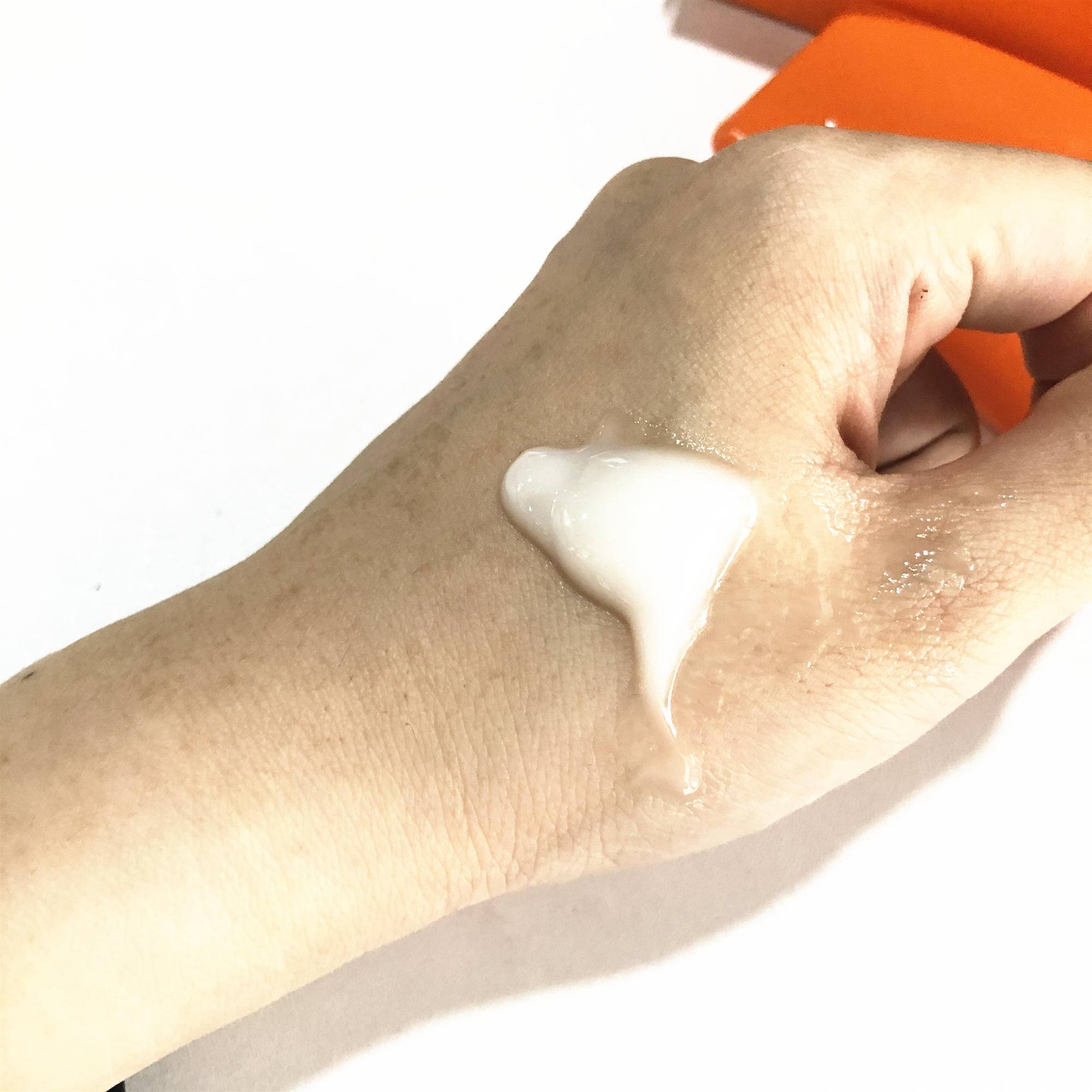 晒后晒伤发红修复最有效的办法,晒后修护可以涂抹晒伤的皮肤吗