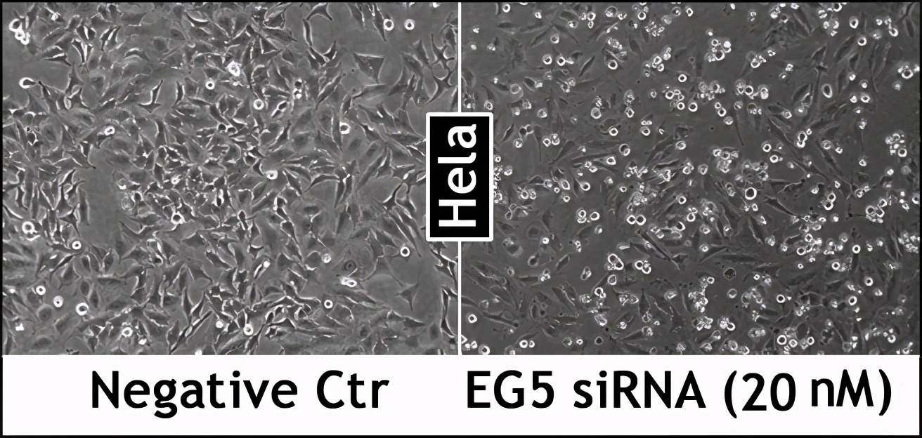 注射一针疫苗，就能杀死身上所有癌细胞，这种理想离实现有多远？