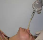 为什么医生看肺炎要做ct,新型肺炎ct特点