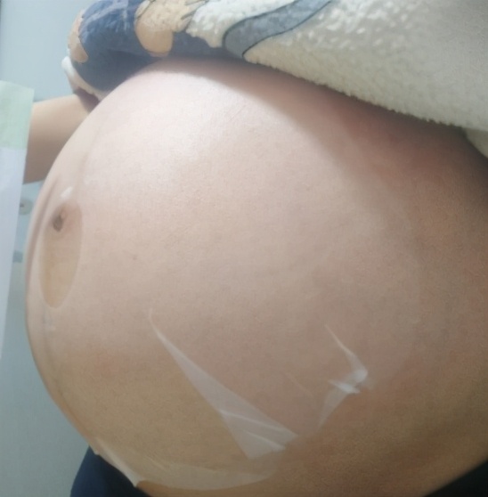 选对防妊娠纹霜让孕妈远离妊娠纹,孕期防妊娠纹用什么橄榄油效果好