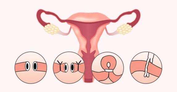 结扎了输卵管还可以复通吗,输卵管结扎后还可以复通吗