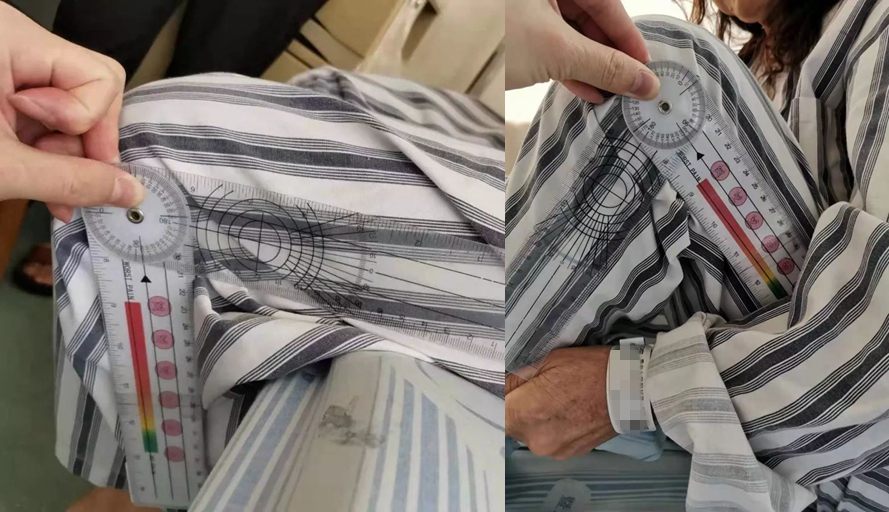 阿婆路边摔伤,阿婆骨折手术