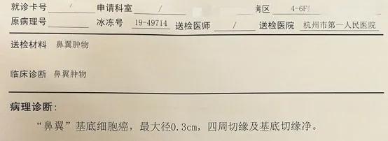 脸上长痣会容易癌变吗,脸上痣随着年龄长大会癌变吗