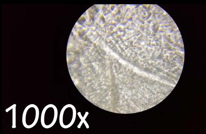 耳屎用显微镜放大是什么样,耳屎在显微镜下是不是活的