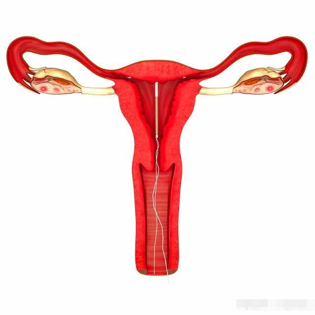 取下节育环后多久能怀孕,备孕二胎取节育环在什么时间最好