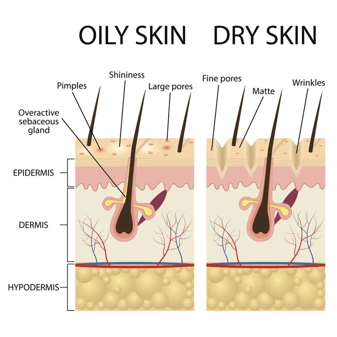 收缩毛孔比较靠谱的方法,收缩毛孔美颜妙招
