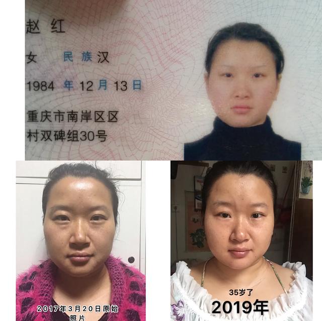 补充胶原蛋白是智商税吗,吃肉皮能补充胶原蛋白吗