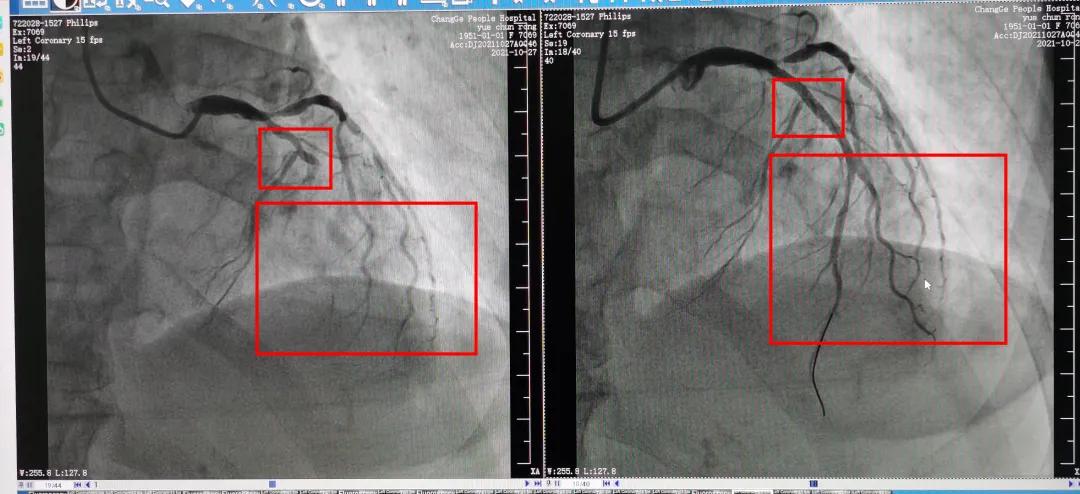 闀胯憶浜烘皯鍖婚櫌鏁戞彺鐜板満,闀胯憶鎵嬫湳