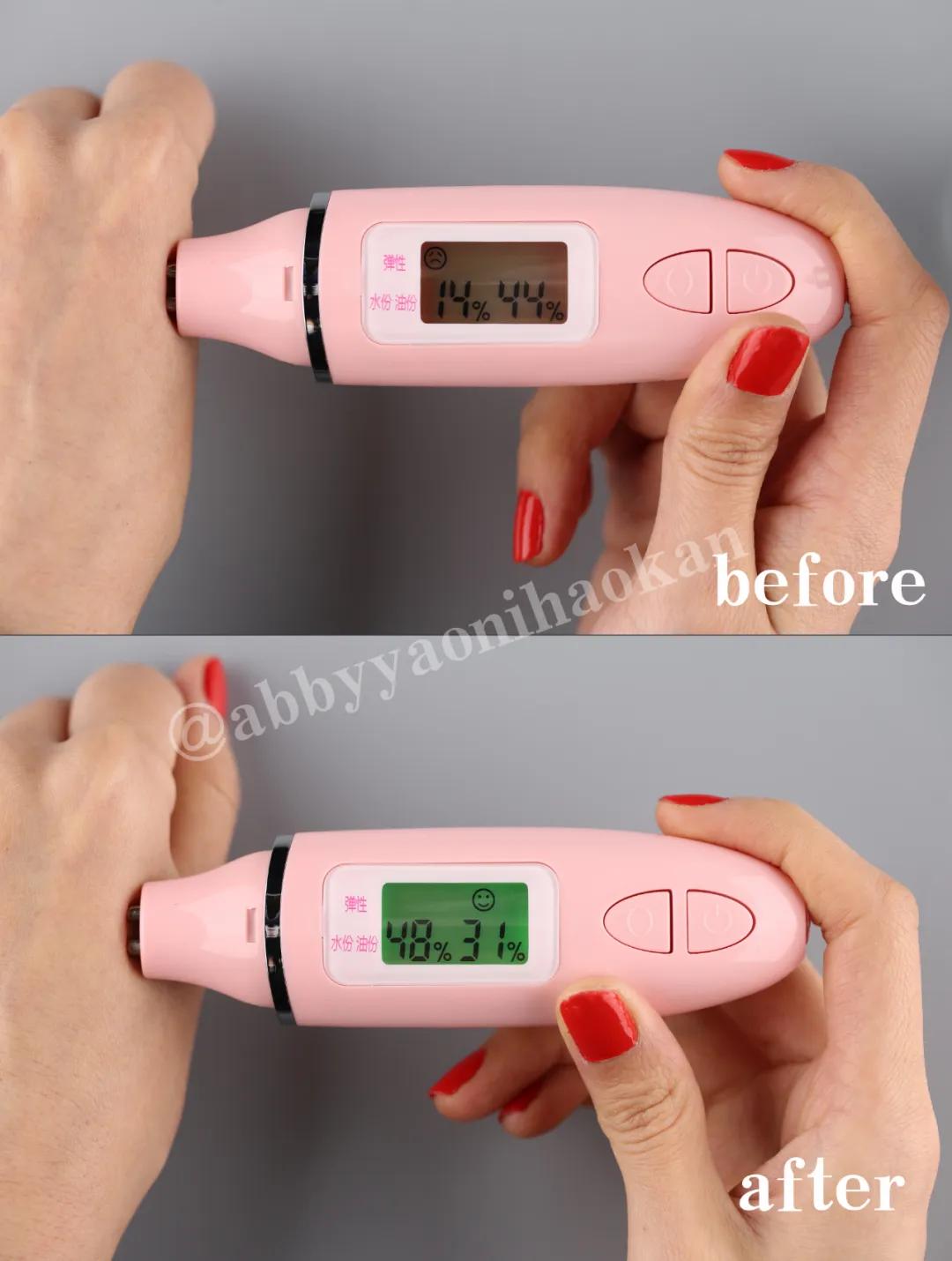 做医美的女生有多少,做医美的女生有什么特征