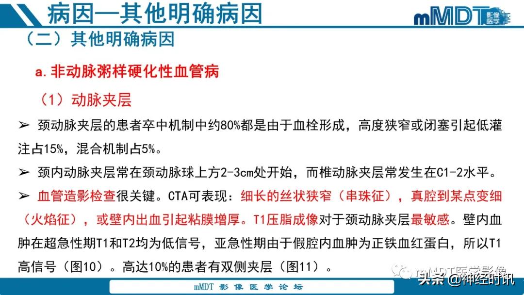 急性缺血性脑卒中ppt素材图片,青年缺血性脑卒中ppt