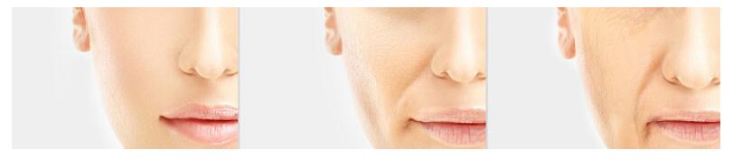 鼻整形修复三次,鼻整形五十年后