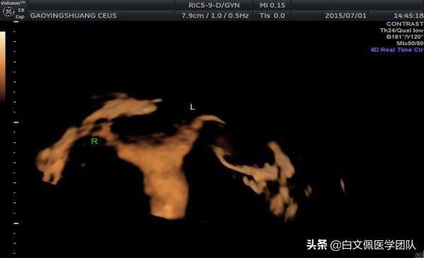 北京世纪坛妇科,北京世纪坛医院妇产科专家