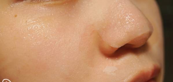 蒂佳婷药丸黑面膜测评,蒂佳婷银色药丸面膜正确使用方法