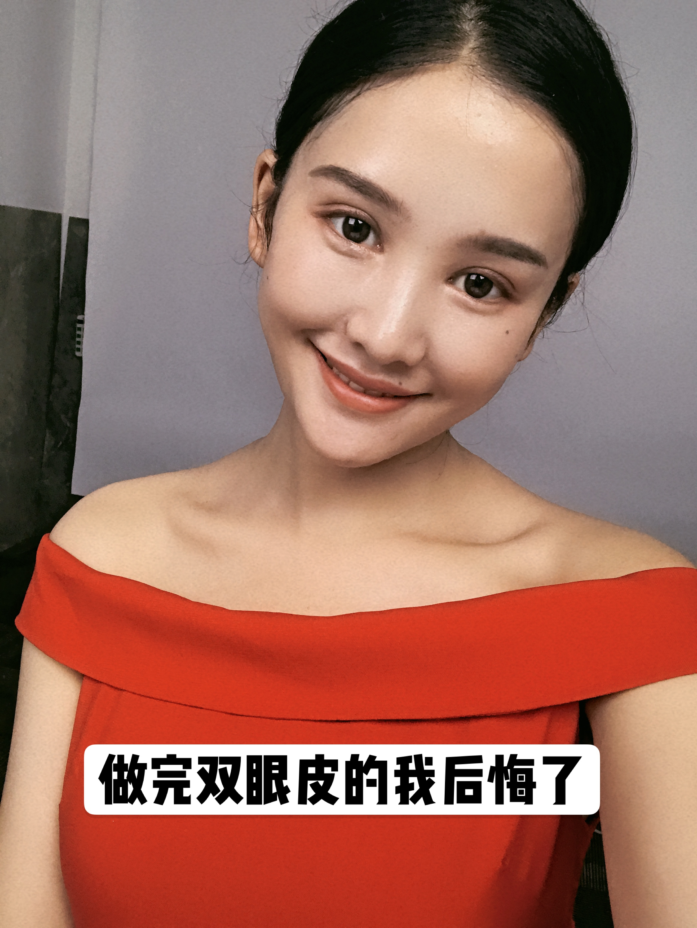 做了埋线双眼皮后悔了,做完双眼皮后悔的多吗