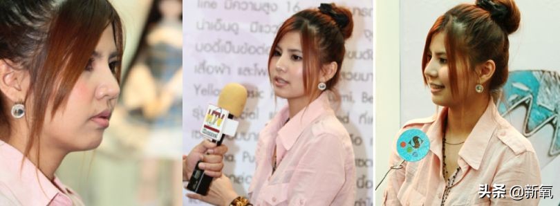 18岁土肥圆豪掷800万全身整形，鼻子6次大整假体穿出，效果却超美