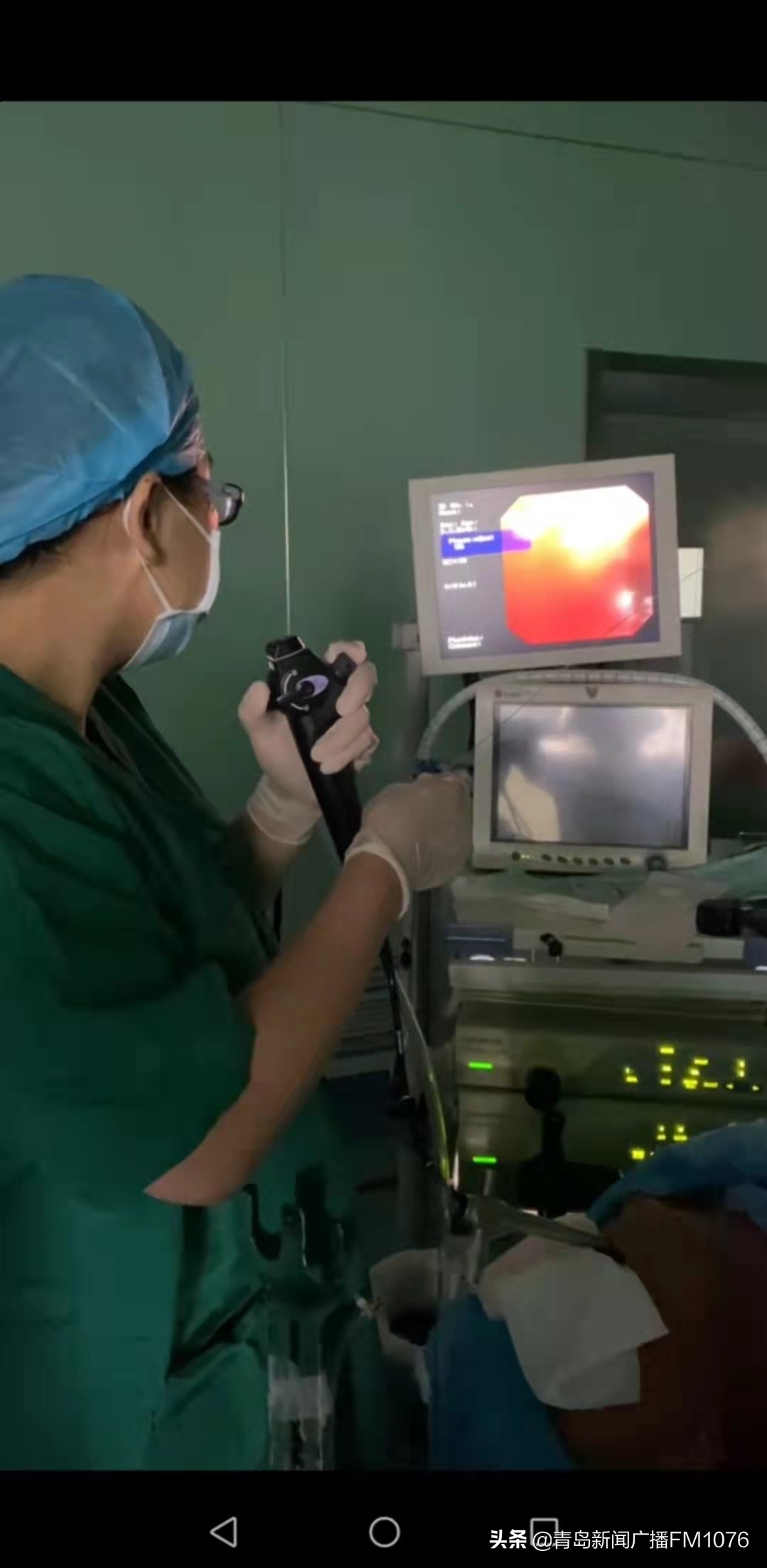 双镜腹腔镜联合治疗胃癌,双镜联合切除食管癌