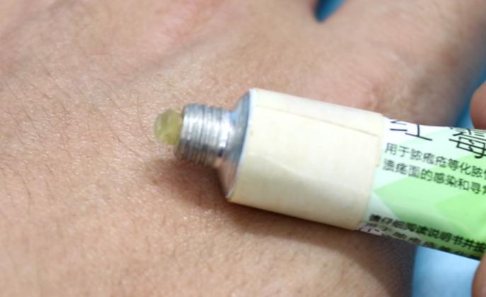 红霉素软膏在眼部涂,红霉素软膏除了涂眼还能涂哪里