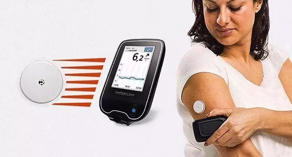 雅培动态血糖仪优缺点,雅培动态血糖仪测得准吗