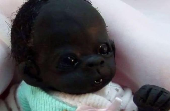 被称为世界上最黑的婴儿,世界上最黑的婴儿现在长什么样子