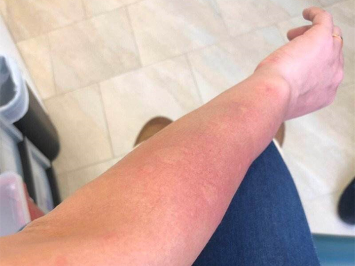 猫毛辟谣,有人说猫毛过敏怎么回答