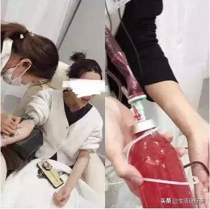 体外洗血,5万一次血液净化美容防癌