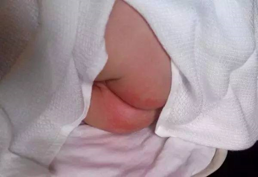 新生儿如何进行皮肤护理,新生儿皮肤常见问题照护与清洁