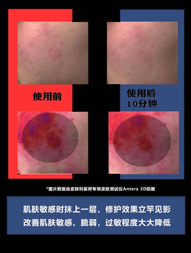 肌肤发红发痒怎么护理,泛红刺痛干痒如何修复