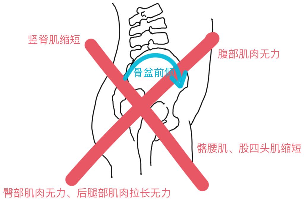 为啥大腿后侧拉伸很紧,大腿后侧筋拉伸导致疼痛能自愈吗