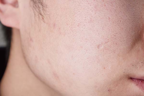 缺乏维生素b2吃了对身体有什么用,缺少维生素b2对身体有什么影响