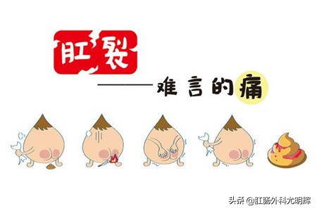 肛门撕裂了怎么治疗,肛门撕裂怎么治疗最好