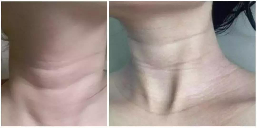 一招看出你的身体年龄,身体哪个部位暴露年龄