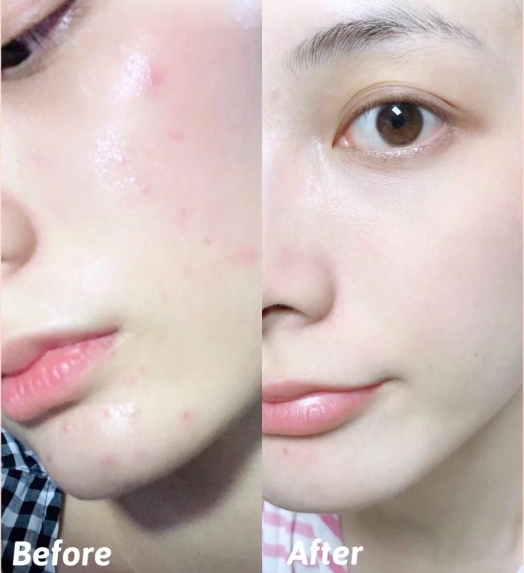 明星都是用什么牌子的美容仪,半个娱乐圈都用美容仪吗