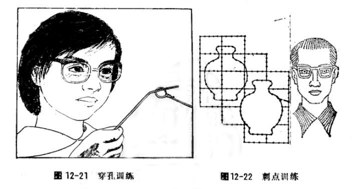 弱视训练3个月矫正视力右0.7左1.0,儿童弱视练习串珠