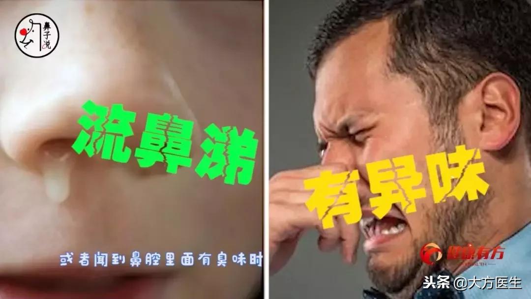 最好的方法清除鼻腔异物,鼻腔异物处理方法图片