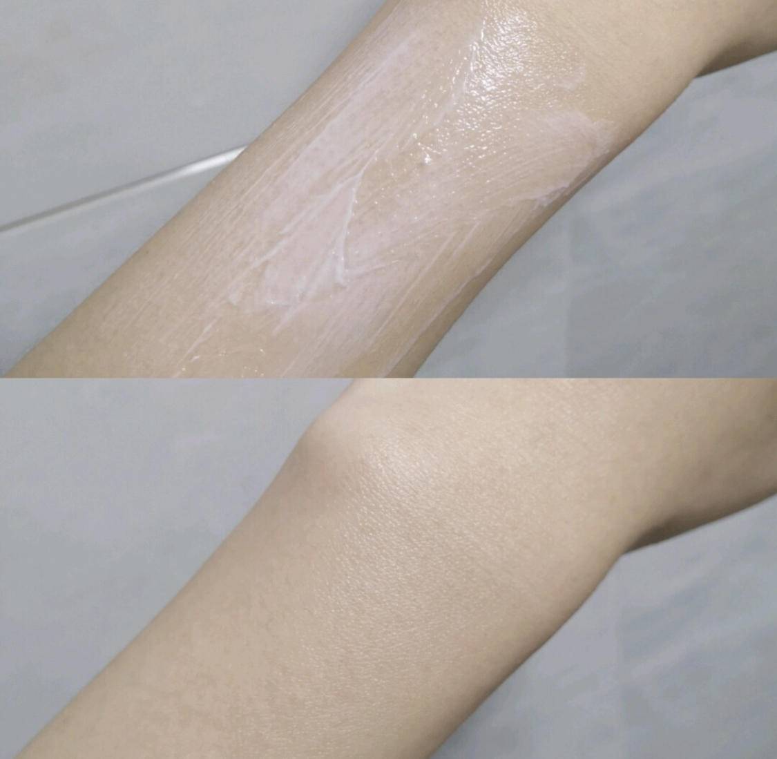 关节黑改善小妙招,关节发黑护肤小妙招