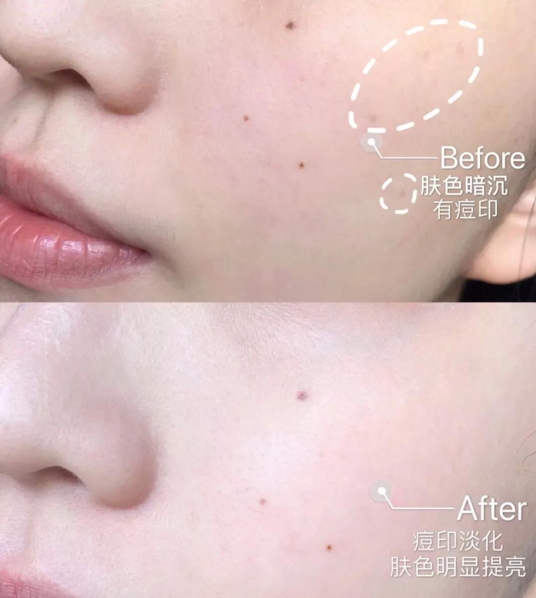 韩束消细纹,韩束洗白肌面奶