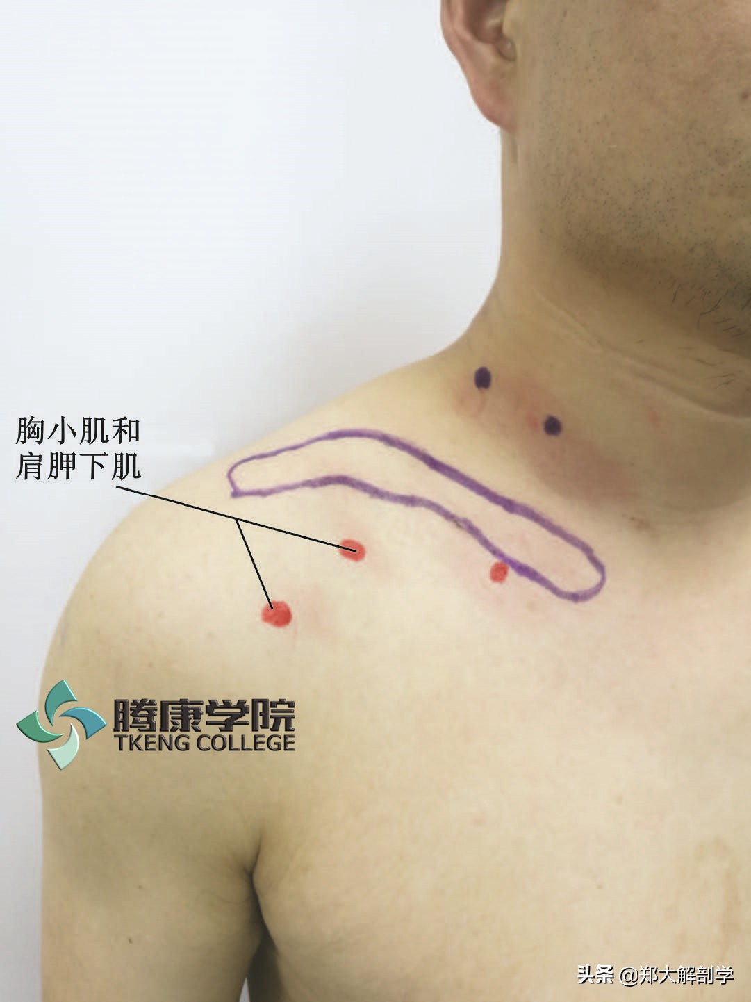 臂丛三束的主要分支,臂丛锁骨下部的主要分支及分布