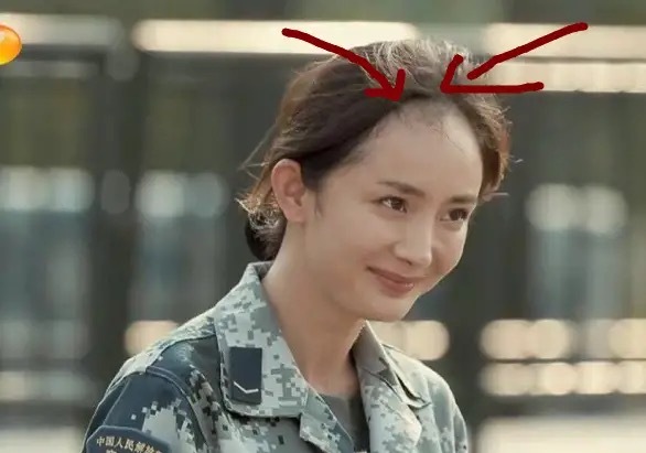 蒋梦婕植发是哪一期,蒋梦婕植发视频完整版