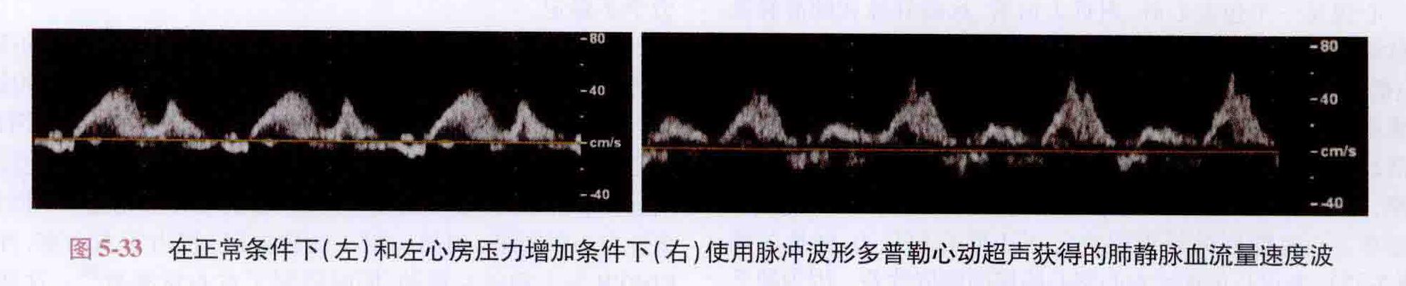 卡普兰心脏麻醉学（超声时代）学习笔记24