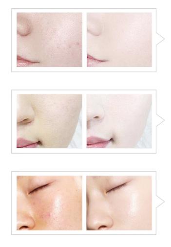 认准成分不花冤枉钱,美白精华原料选择