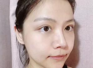 微整形美白针,微整形是永久的吗