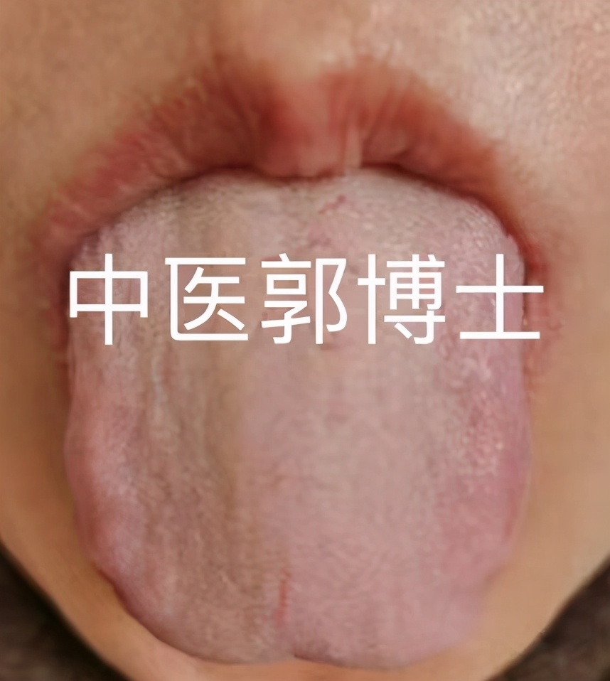 脾胃寒凉腹泻四神丸,脾胃虚寒吃四神丸管用吗
