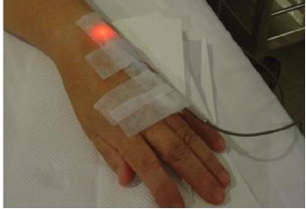 一代重生｜氦氖雷射—血液垃圾清洁工无痛见效快