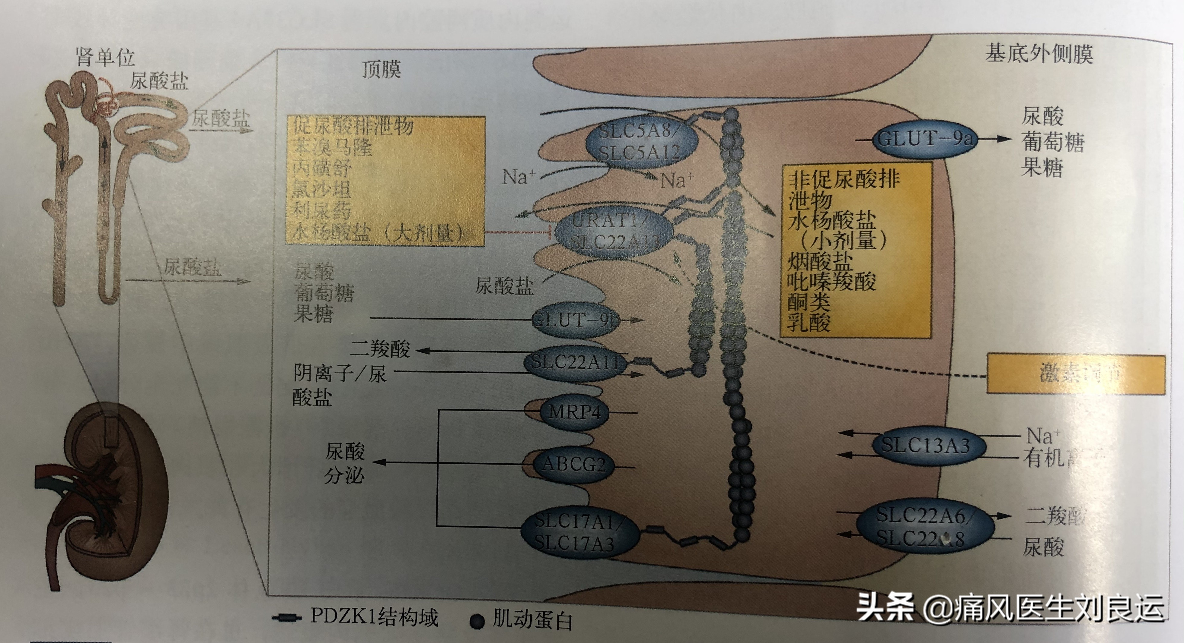 痛风是遗传因素大还是后天因素大,痛风是不是有遗传的因素呀
