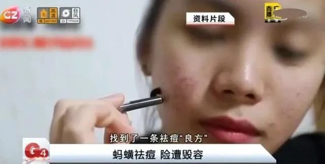 这三种美容方法您用过吗,各种美容秘方小常识